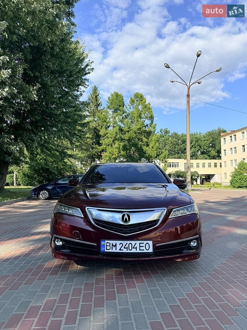 Acura TLX 2015 VIN 19UUB1F50FA023187 фото оголошення 8 з 13