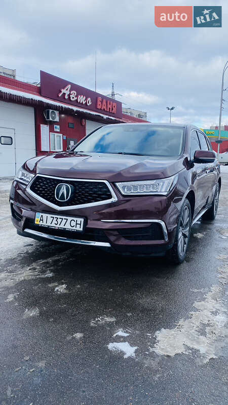 Позашляховик / Кросовер Acura MDX 2017 в Вишгороді фото 5 Позашляховик / Кросовер Acura MDX 2017 в Вишгороді
