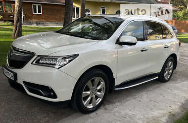 Acura MDX 2014