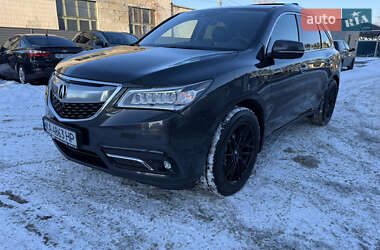 Acura MDX 2015