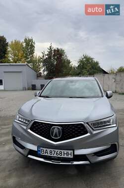 Acura MDX 2017