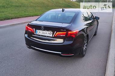 Седан Acura TLX 2015 в Киеве