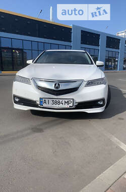 Седан Acura TLX 2016 в Киеве