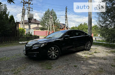 Седан Acura TLX 2015 в Києві