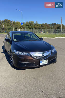 Седан Acura TLX 2015 в Одесі