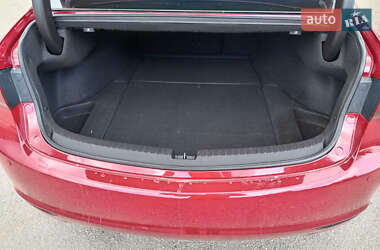 Седан Acura TLX 2016 в 