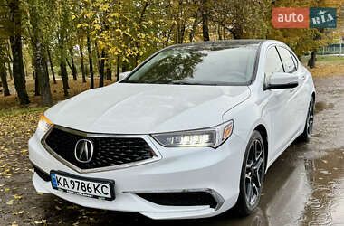Седан Acura TLX 2019 в Киеве