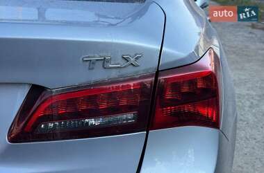 Седан Acura TLX 2016 в  фото 5 Седан Acura TLX 2016 в