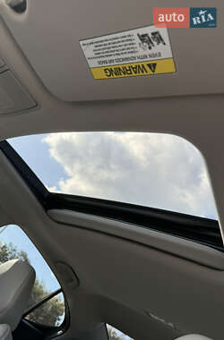 Седан Acura TLX 2016 в Житомире