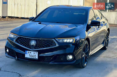 Седан Acura TLX 2018 в Житомире