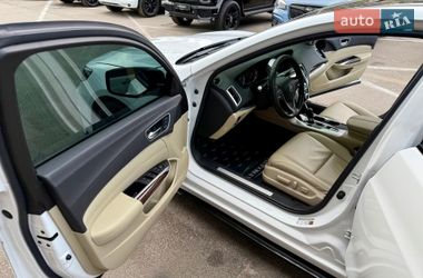 Седан Acura TLX 2018 в Києві