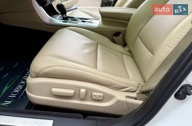Седан Acura TLX 2018 в Києві