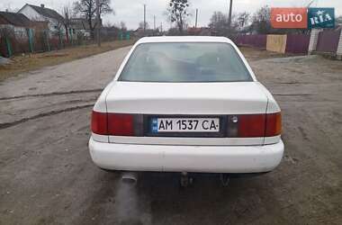 Седан Audi 100 1991 в Житомирі