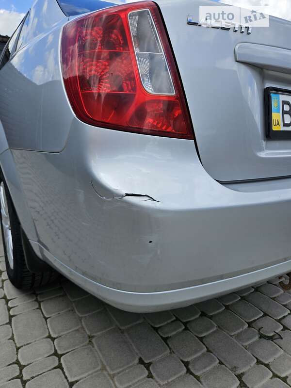 Седан Chevrolet Lacetti 2011 в Ірпені