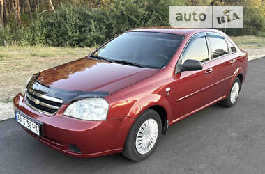 Седан Chevrolet Lacetti 2007 в Шостці