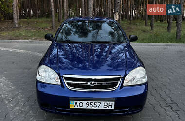 Седан Chevrolet Lacetti 2004 в Бучі