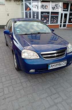 Седан Chevrolet Nubira 2005 в Житомирі