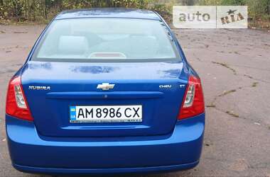 Седан Chevrolet Nubira 2005 в Житомире