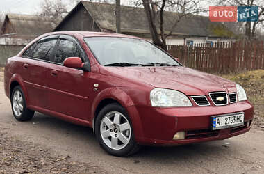 Седан Chevrolet Nubira 2004 в Чернігові