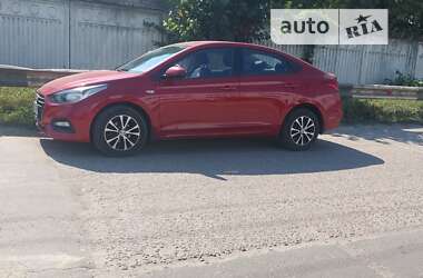 Седан Hyundai Accent 2017 в Броварах