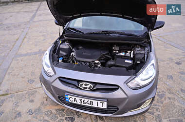 Хэтчбек Hyundai Accent 2017 в 