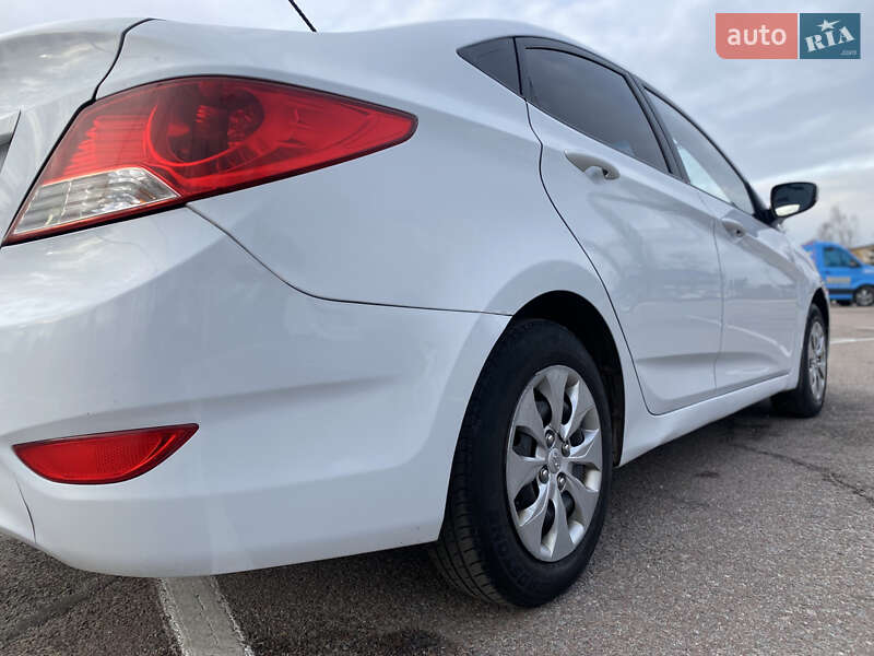 Седан Hyundai Accent 2018 в Житомирі