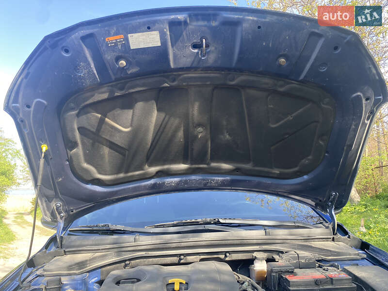 Седан Hyundai Elantra 2016 в Дніпрі фото 71 Седан Hyundai Elantra 2016 в Дніпрі