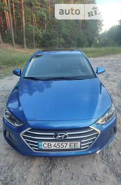 Седан Hyundai Elantra 2016 в Чернигове