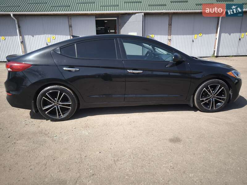 Седан Hyundai Elantra 2016 в Житомире