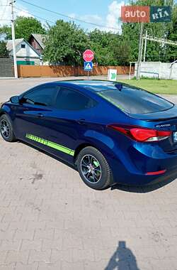 Седан Hyundai Elantra 2015 в Житомирі
