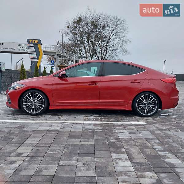 Седан Hyundai Elantra 2018 в Киеве фото 6 Седан Hyundai Elantra 2018 в Киеве