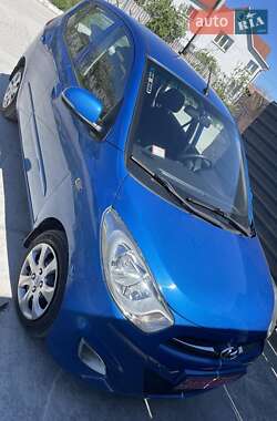 Хэтчбек Hyundai i10 2010 в Вараше