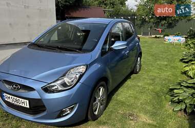 Хэтчбек Hyundai ix20 2014 в Звягеле