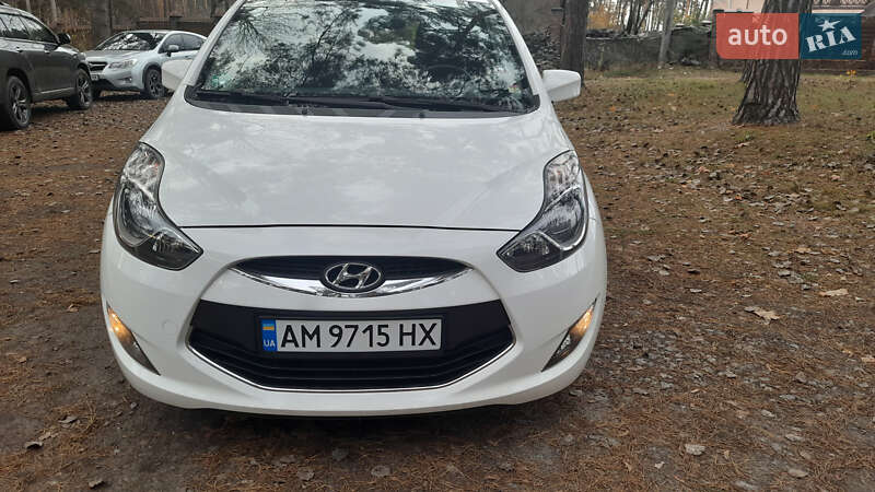 Хетчбек Hyundai ix20 2013 в Житомирі фото 2 Хетчбек Hyundai ix20 2013 в Житомирі