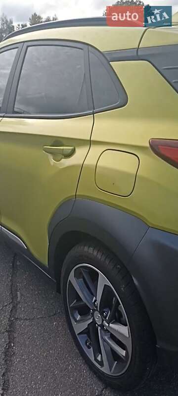 Внедорожник / Кроссовер Hyundai Kona 2019 в Киеве фото 11 Внедорожник / Кроссовер Hyundai Kona 2019 в Киеве