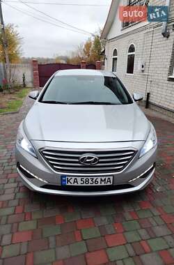 Седан Hyundai Sonata 2014 в Прилуках