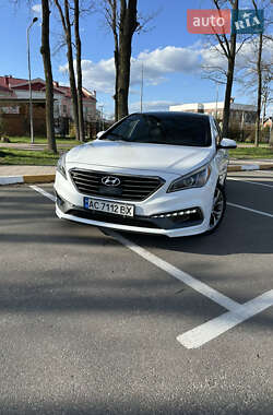 Hyundai Sonata 2015 Hyundai Sonata 2015