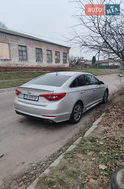 Седан Hyundai Sonata 2014 в Прилуках