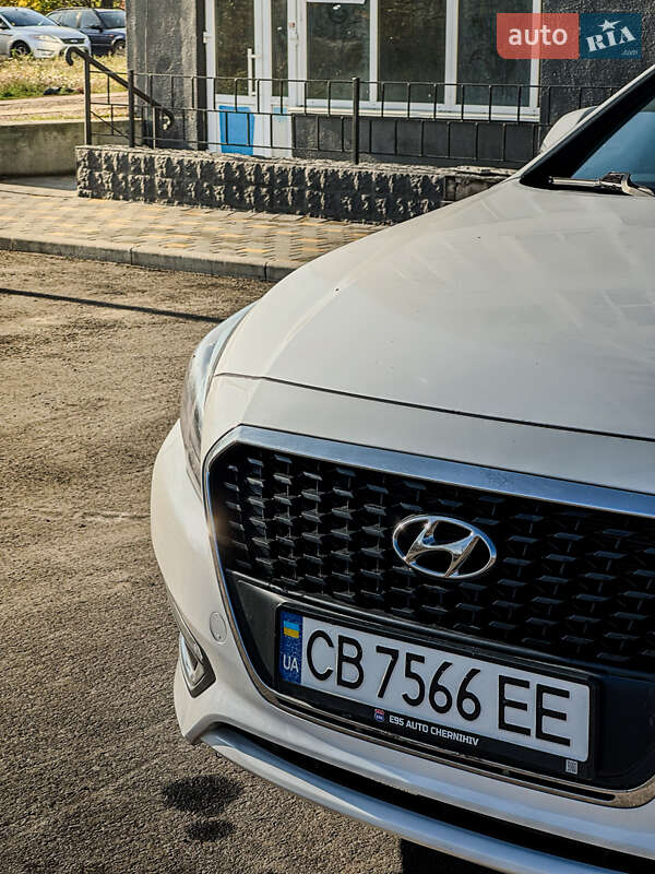 Седан Hyundai Sonata 2015 в Чернігові