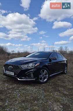 Седан Hyundai Sonata 2018 в Бердичеві