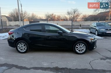 Седан Mazda 3 2017 в Чернигове фото 8 Седан Mazda 3 2017 в Чернигове