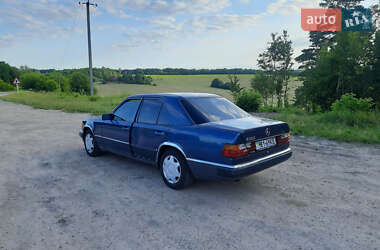 Седан Mercedes-Benz E-Class 1987 в 