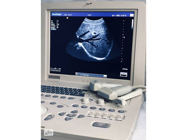 УЗИ \УЗД аппарат SonoScape SSI-1000/ Доплер PW/ Конвекс Линейка Интрао